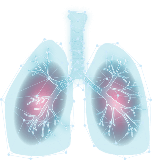 lung-1